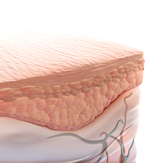 표피이식치료 장비사진