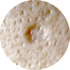 박스카 흉터 사진