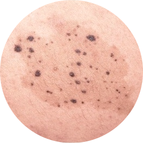 반문상모반 사진