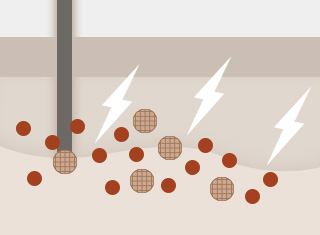 백반증·건선 치료_2