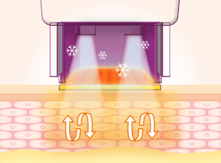 써마지FLX 시술과정_5