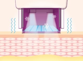 써마지FLX 시술과정_6