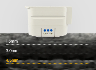 울쎄라피프라임 시술과정_1