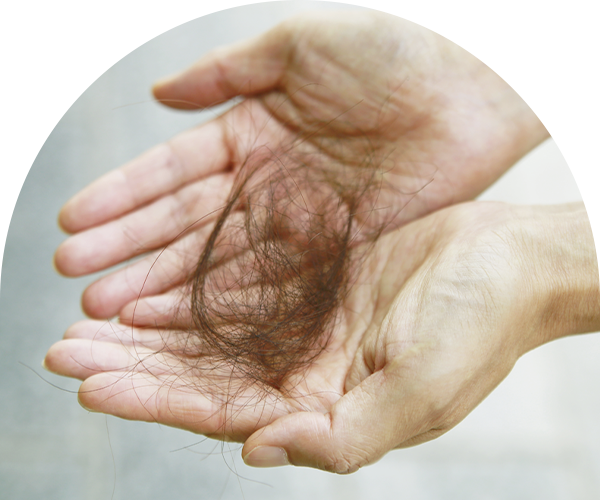 탈모 다리 사진