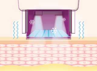 써마지FLX 시술과정_4