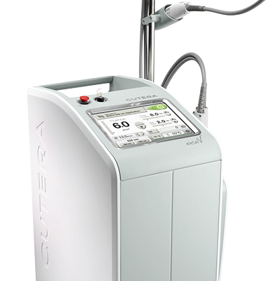 엑셀브이레이저